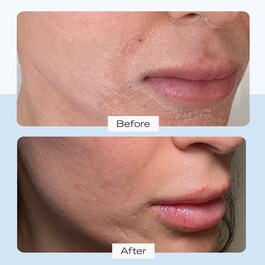 Ultra Repair Cream Intense Hydration - Hydratační krém