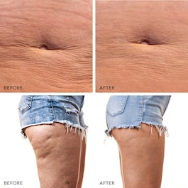 BEAR™ 2 body - Celotělový mikroproudový tonizační přístroj