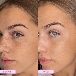 The product image is missing!