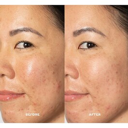 Dark Spot Toner - Tonikum