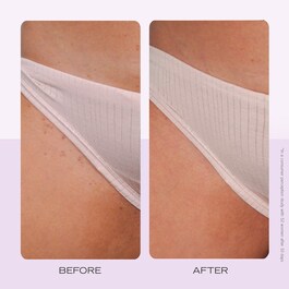 Ingrown Hair Pads – Kompostovatelné tamponky na zarostlé chloupky, 60 ks