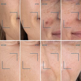 Blue Retinol Serum Night - Noční sérum na obličej