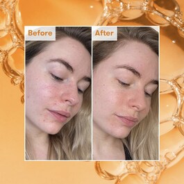 Radiance Ready Steady Glow Daily Tonic - Tonikum