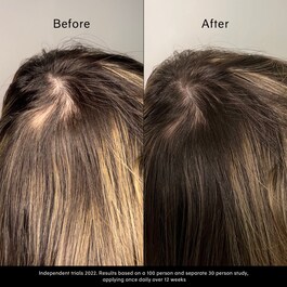 Pitta Growth Serum – Růstové sérum
