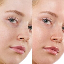 Hy-Gen Primer Serum – Podkladové sérum na obličej