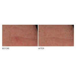 Advanced Retinol + Ferulic - Péče proti vráskám