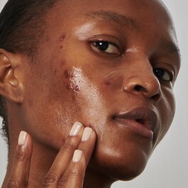 Super Solutions Niacinamide 20% Serum - Pleťové sérum