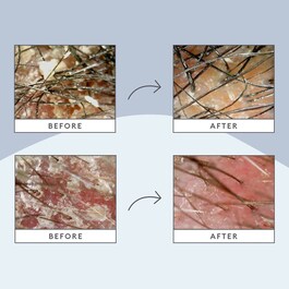 Scalp Revival™ - Sada péče o vlasy