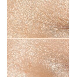 Clinique Smart Clinical Repair™ Wrinkle Correcting Cream - Krém