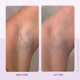 Ingrown Hair Pads – Kompostovatelné tamponky na zarostlé chloupky, 60 ks