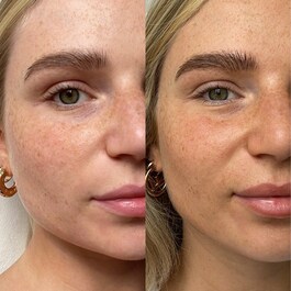 Self Tan Drops - Samoopalovací kapky na obličej