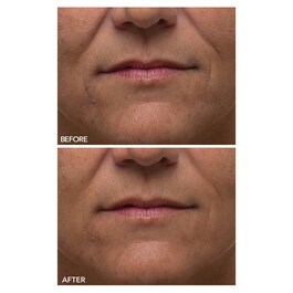 Alpha Beta® - Ultrajemný každodenní peeling