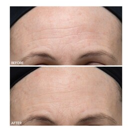 Alpha Beta® - Ultrajemný každodenní peeling