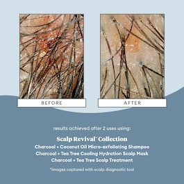 Scalp Revival Charcoal Tea Tree Scalp - Vyživující olej