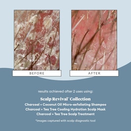 Scalp Revival Charcoal Tea Tree Scalp - Vyživující olej