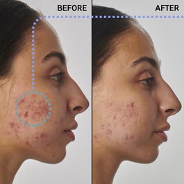 Super Solutions Retinol 1% Serum - Pleťové sérum