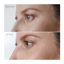 IRIS™ Firming PM Eye Serum - Noční sérum s retinolem na oči 
