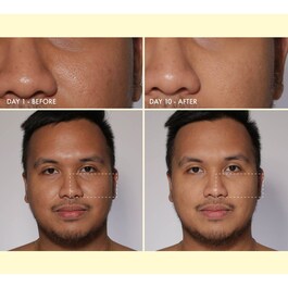 Yo Glow Mini - Peeling