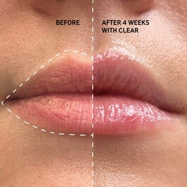 Tripeptide Plumping Lip Balm - Balzám na rty