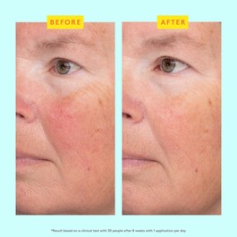 C-Luma™ Hydrabright Serum – Sérum s vitaminem C