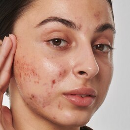 Super Solutions Retinol 1% Serum - Pleťové sérum