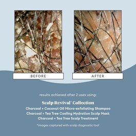 Scalp Revival Micro-Exfoliating Shampoo - Šampon