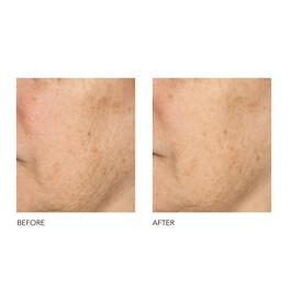 Alpha Beta® - Každodenní peeling s univerzálním složením