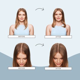 Scalp Revival™ - Sada péče o vlasy
