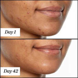 U.F.O. Ultra Clarifying Face Oil - Exfoliační suchý olej v cestovním balení