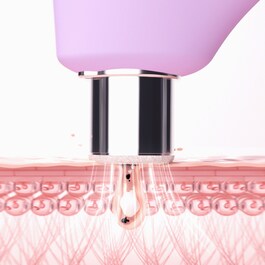 KIWI™ derma - přístroj na mikrodermabrazi a čištění pórů