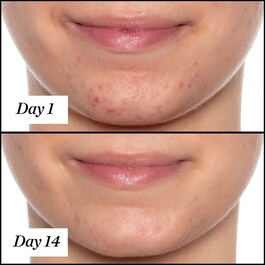 U.F.O. Ultra Clarifying Face Oil - Exfoliační suchý olej v cestovním balení