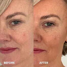 Tanning Anti-Age Serum - Samoopalovací sérum 