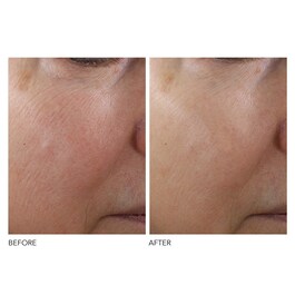 Advanced Retinol + Ferulic - Zpevňujicí koncentrované sérum