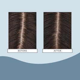 Scalp Revival - Hydratační a osvěžující maska na pokožku hlavy