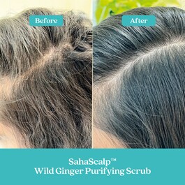 SahaScalp™ Reset Kit - Sada pro péči o pokožku hlavy