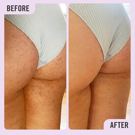 KP Smoothing Body Scrub - Tělový peeling