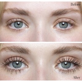 Duo Lift + Light Eye - Sada