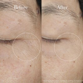 Tea Elixir Skin Resilience Activating Serum - Aktivační sérum pro pružnost