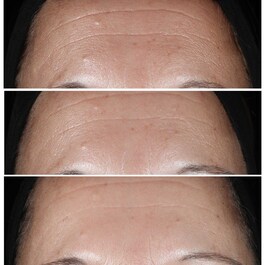 Smart Clinical Repair Serum - Sérum proti vráskám