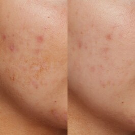B3 Nice 10% Niacinamide – Rozjasňující sérum