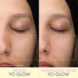 Yo Glow Mini - Peeling