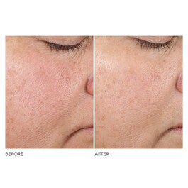 Advanced Retinol + Ferulic - Zpevňujicí koncentrované sérum