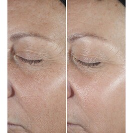 Smart Clinical Repair Serum - Sérum proti vráskám