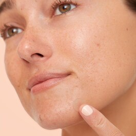 Acne Dots - Náplasti na nedokonalosti pleti