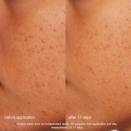 Daily Microfoliant - Mechanický peeling