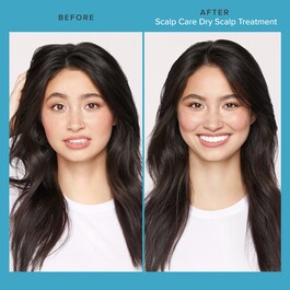 Scalp Care Dry Scalp Treatment - Vyrovnávací kúra vlasové pokožky