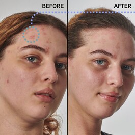 Super Solutions Urea 10% Moisturizer - Pleťové sérum