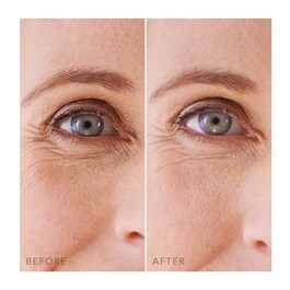 IRIS™ Hydrating & Brightening Hydrogel Eye-Patches - Hydrogelové oční polštářky