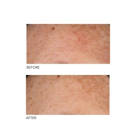 Alpha Beta® - Každodenní peeling s univerzálním složením