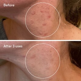 The product image is missing!